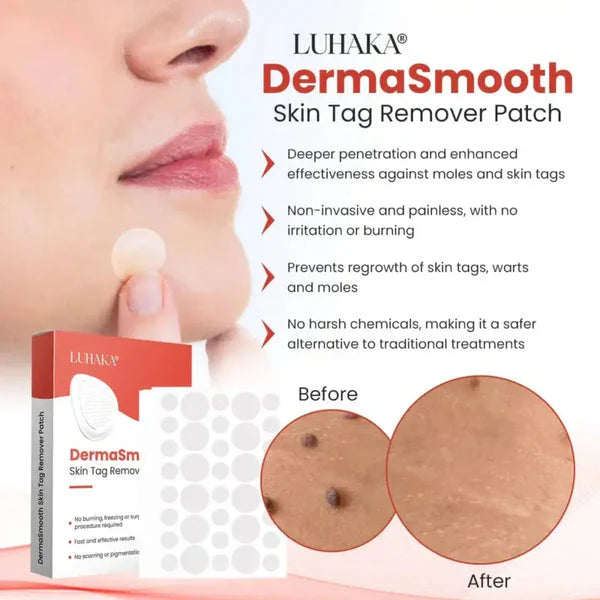 DermaSmooth Skin Tag Remover Patch.